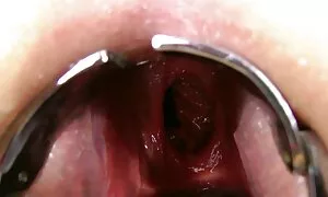 fisting kabili anal, ...