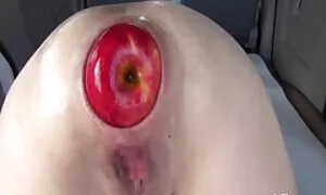 anal fisting kakhulu ...